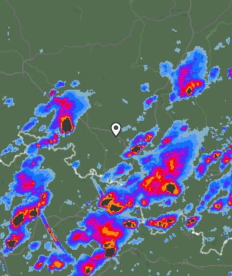 Radar