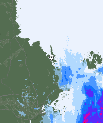 Radar