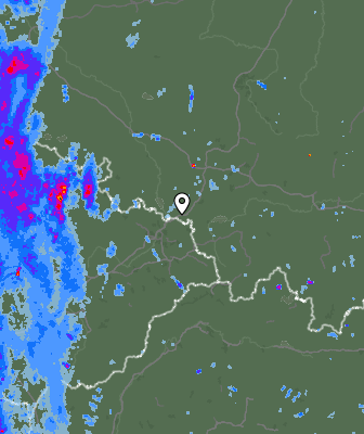 Radar