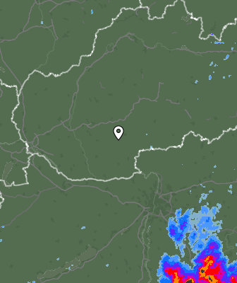 Radar