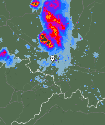 Radar