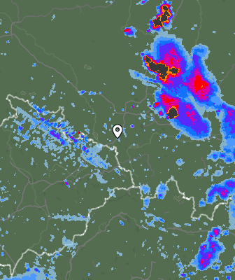 Radar