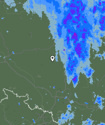 Radar
