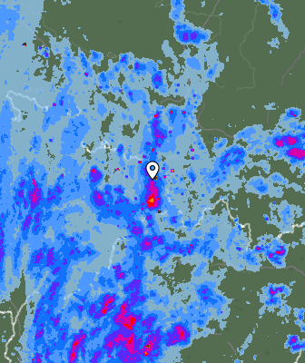 Radar