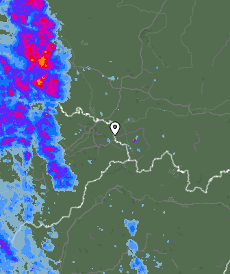 Radar