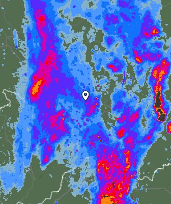 Radar