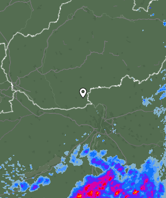 Radar