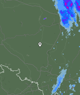Radar