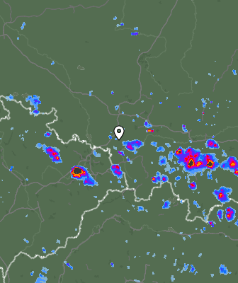 Radar