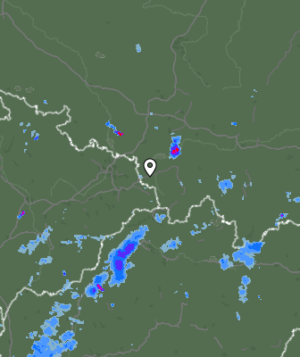 Radar