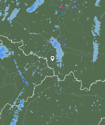 Radar