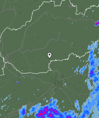 Radar