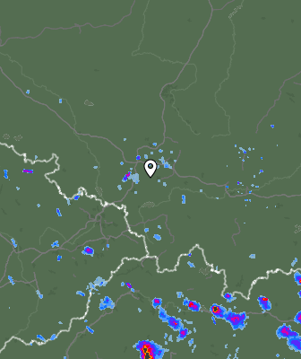 Radar