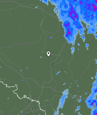 Radar