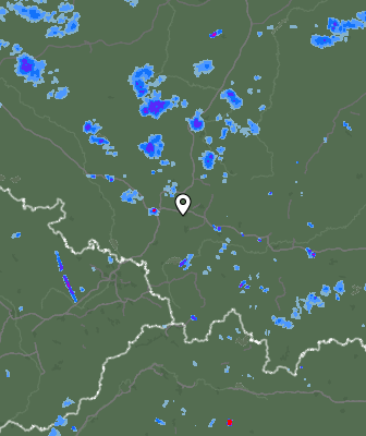 Radar