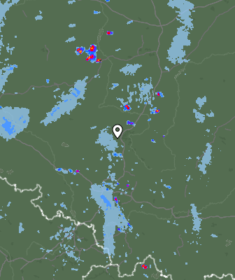 Radar