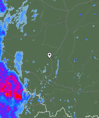 Radar