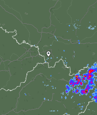 Radar