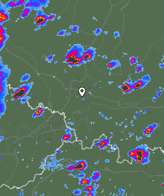 Radar