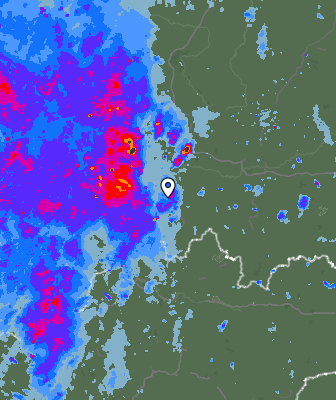 Radar