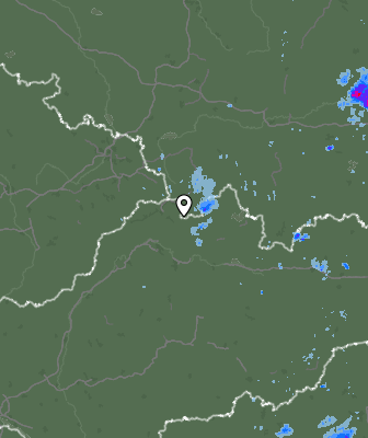 Radar