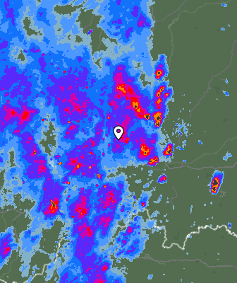 Radar