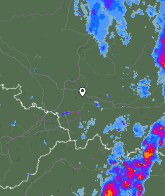 Radar