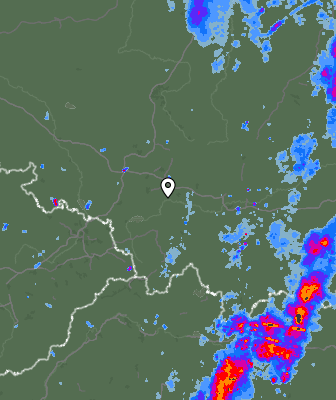 Radar