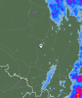 Radar
