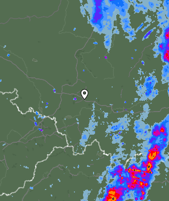 Radar
