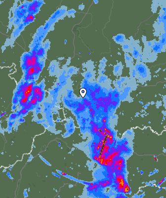 Radar