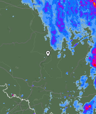 Radar