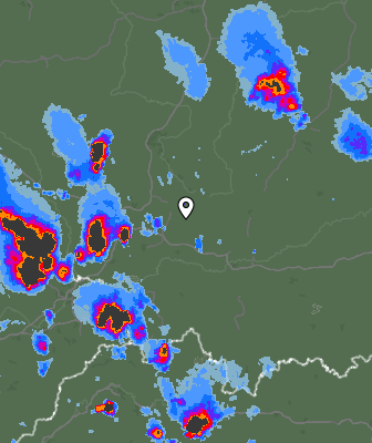 Radar
