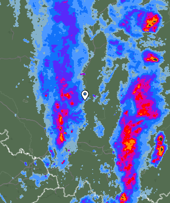 Radar