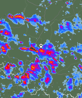 Radar