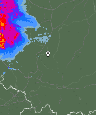 Radar