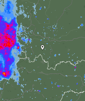 Radar