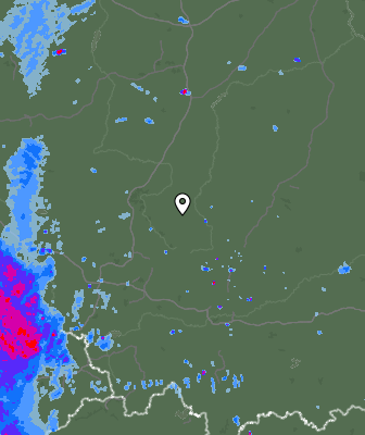 Radar