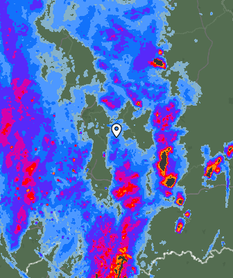Radar