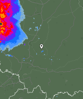 Radar