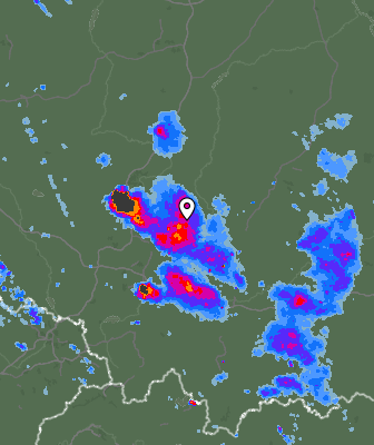 Radar