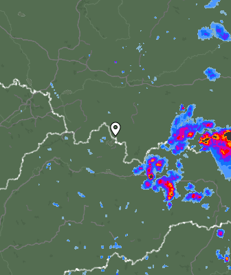 Radar
