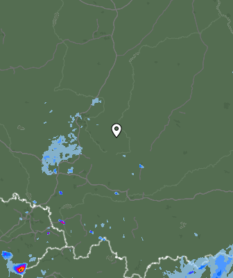 Radar