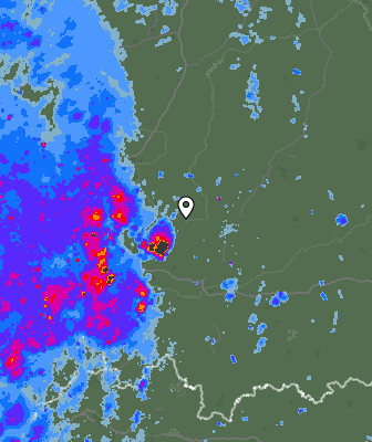 Radar