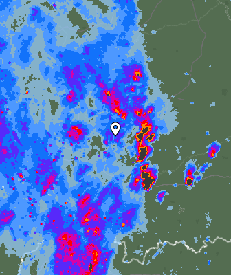Radar