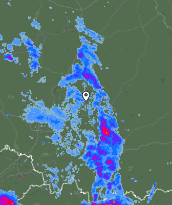 Radar