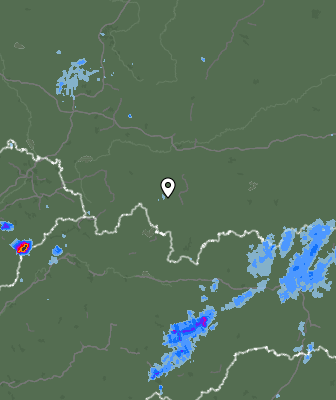 Radar
