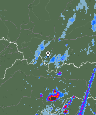 Radar