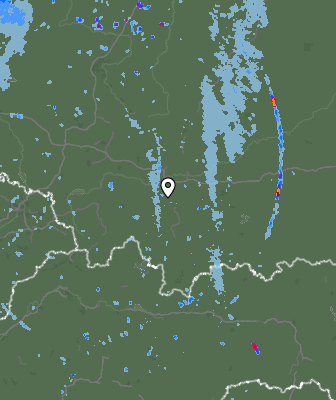 Radar
