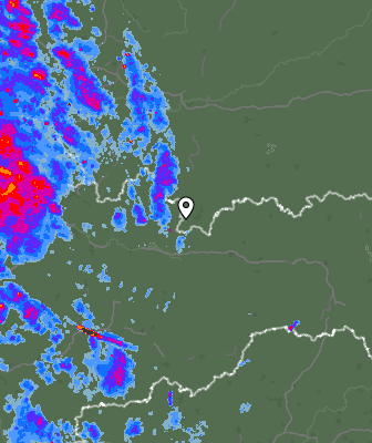 Radar